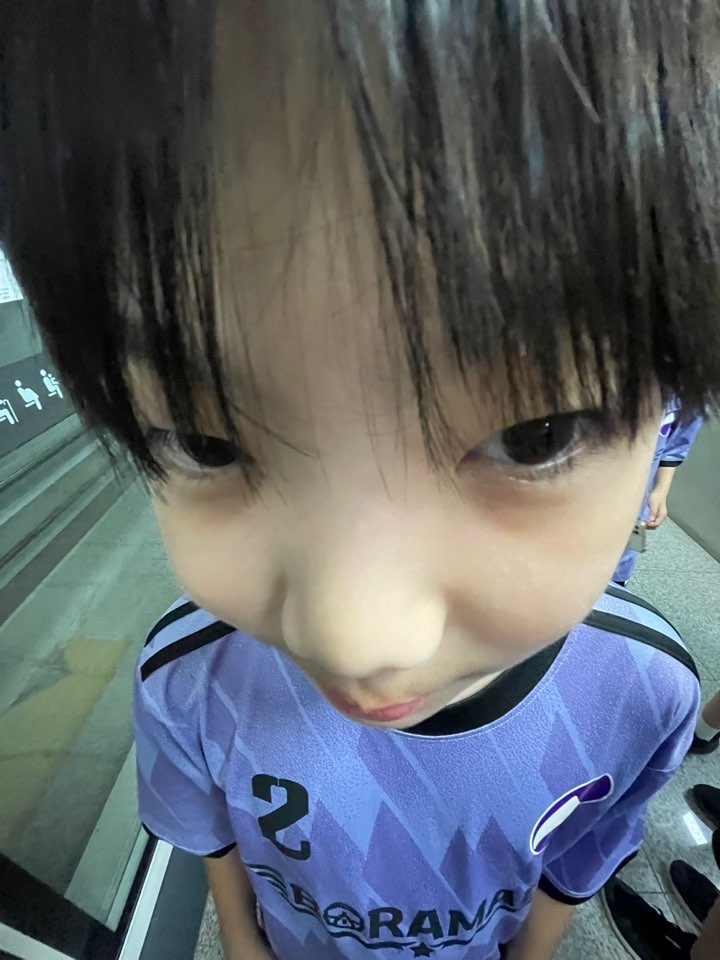 승모근쫩쫩킬러